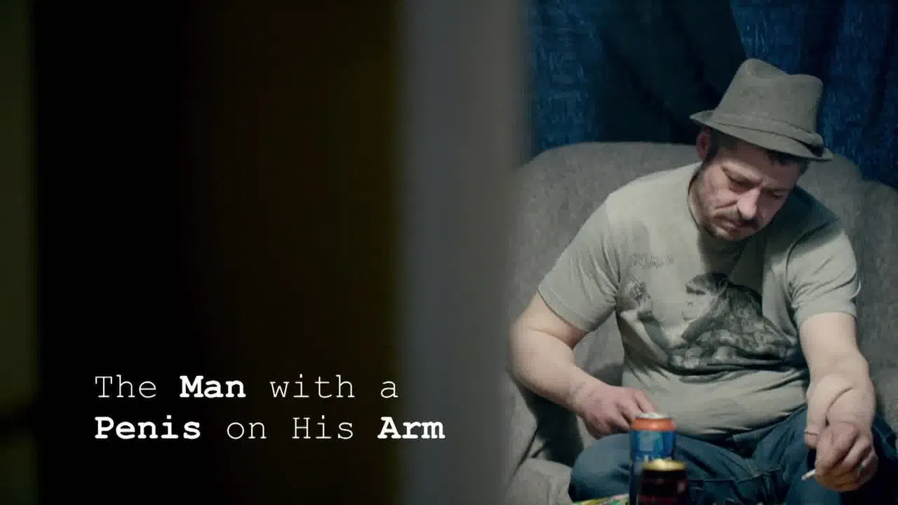 The Man With a Penis on His Arm backdrop