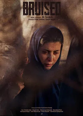 Bruised poster