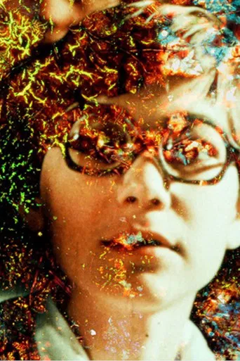 Pigment-Dispersion Syndrome poster