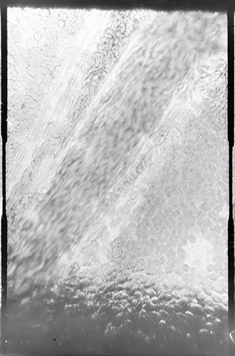 Déplacement des globules de sang dans un vaisseau capillaire poster