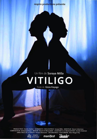 Vitiligo poster