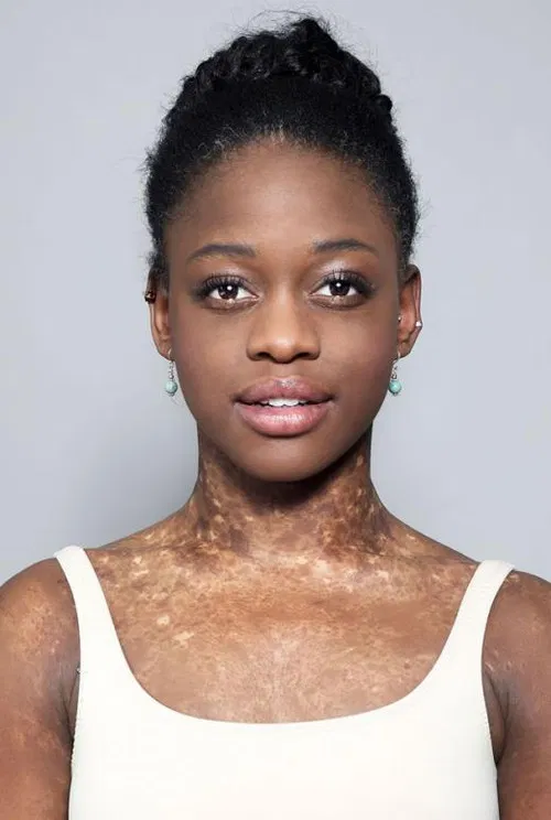 Michaela DePrince profile