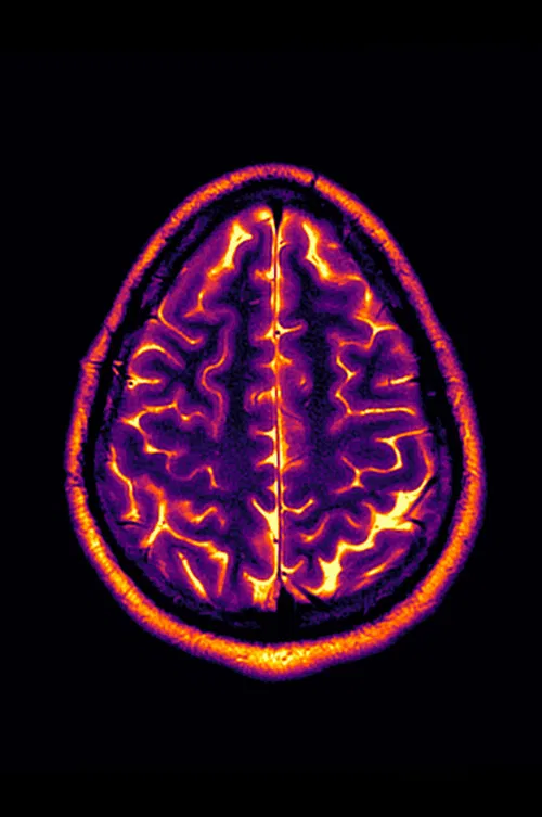 Conclusion: Stable Disease poster
