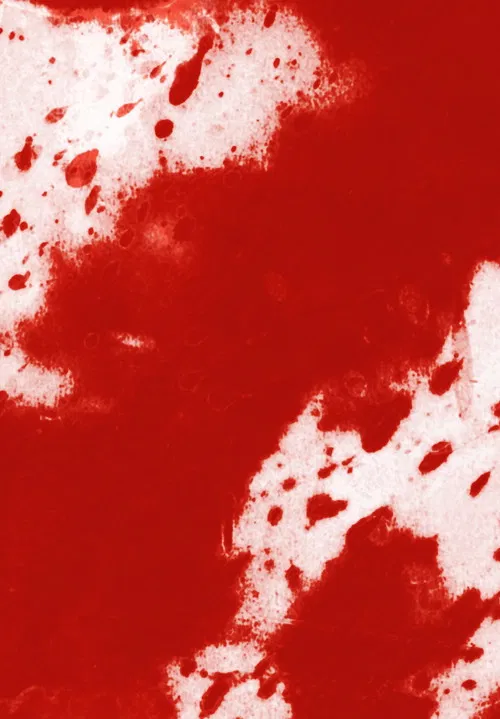 Rutile cautery poster