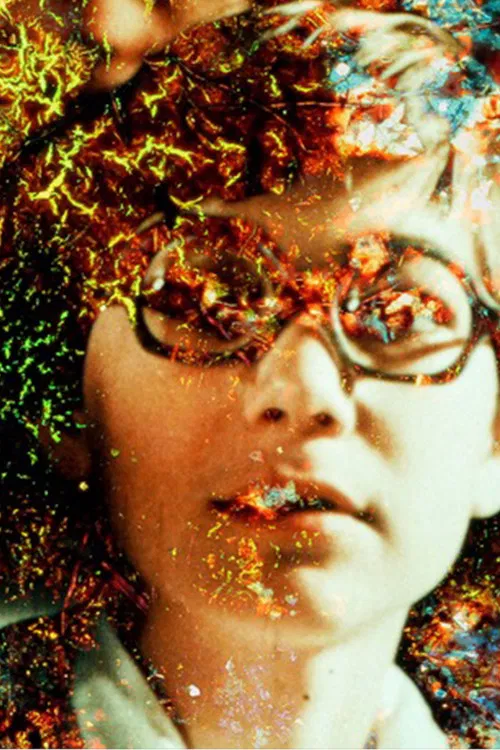 Pigment-Dispersion Syndrome poster