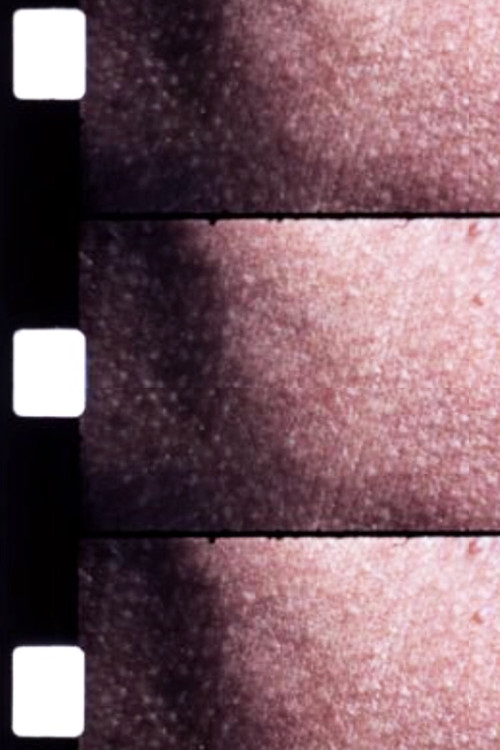 Carotid Artery poster