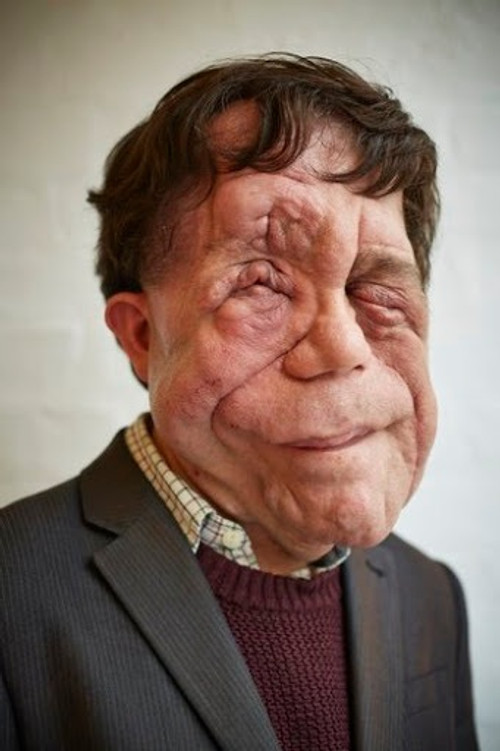 Adam Pearson profile