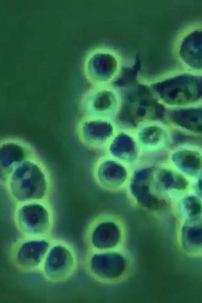 ERYTHROPOIEISIS AND ERYTHROPOIETIN poster background