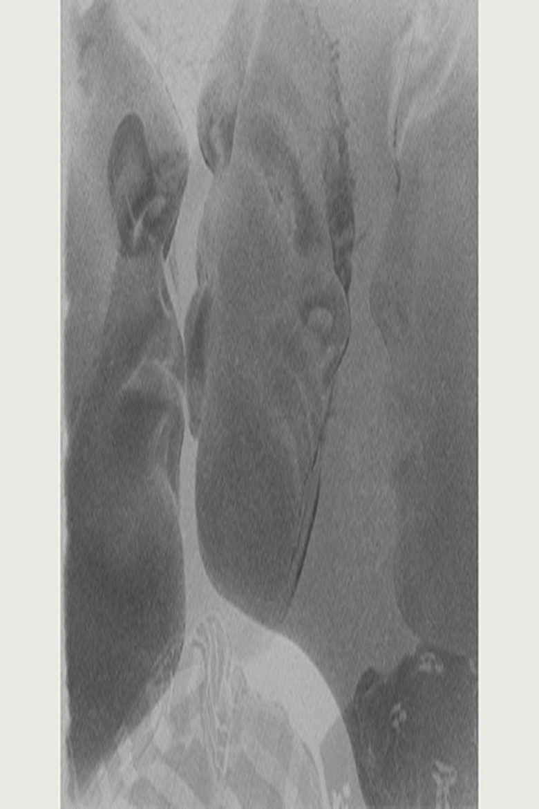 Vis à Vis poster background